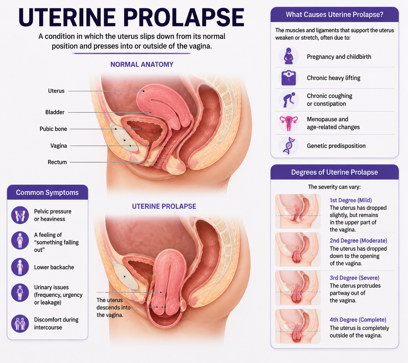 Dr. Dean Martin Uterine Prolapse 